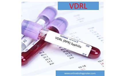 vdrl blood test results